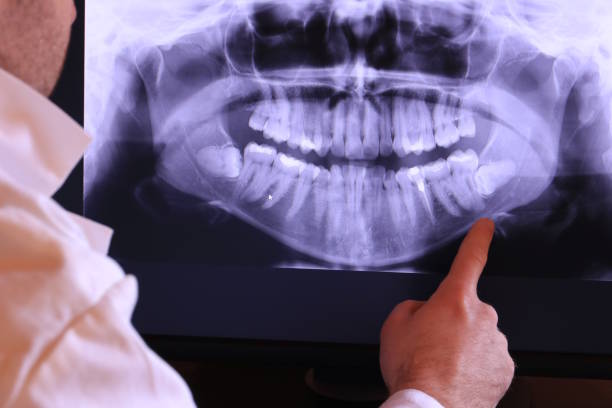 Best Emergency Root Canal Treatment in Bort, GA