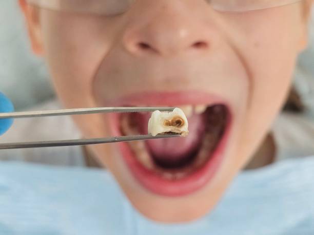 Best Orthodontic Emergency Dentist in Bort, GA